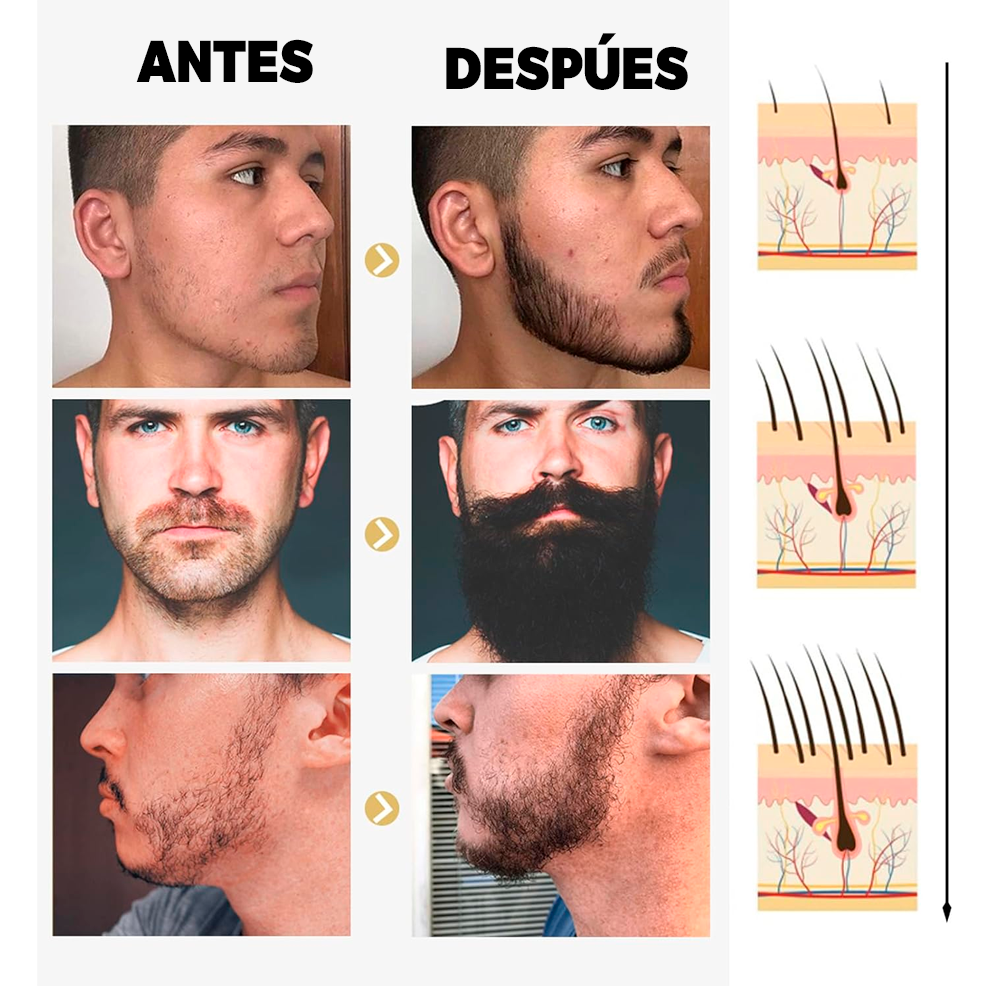 Aceite para Barba DMQ para Hombres | Cuidado y Suavizado del Vello Facial | Fórmula Natural Sin Aroma que Acondiciona, Hidrata y Da Brillo | Ideal para Mantener una Barba Saludable y Bien Cuidada | Presentación 1ml - Image 4